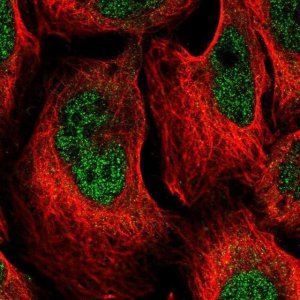 Anti-DCPS antibody produced in rabbit 
