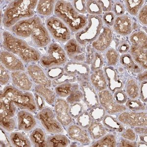 Anti-DCST1 antibody produced in rabbit 