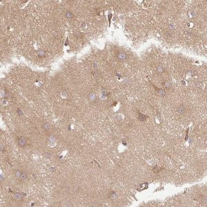 Anti-DCTN1 antibody produced in rabbit HPA034635-100UL