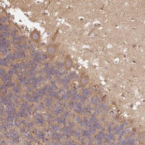 Anti-DCTN1 antibody produced in rabbit HPA034635-100UL