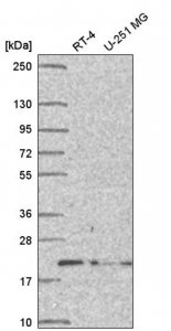Anti-DCTN5 antibody produced in rabbit 