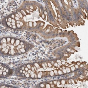 Anti-DCTN6 antibody produced in rabbit 