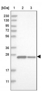 Anti-DCTN6 antibody produced in rabbit 