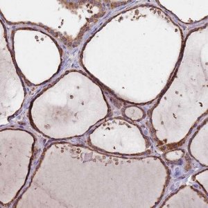 Anti-DCUN1D3 antibody produced in rabbit 