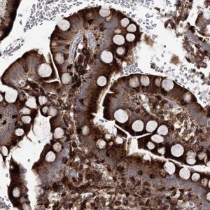 Anti-DCUN1D4 antibody produced in rabbit 