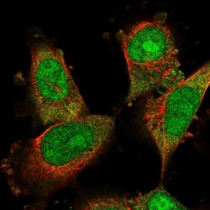 Anti-DDA1 antibody produced in rabbit 