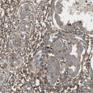 Anti-DDAH2 antibody produced in rabbit HPA012509-100UL