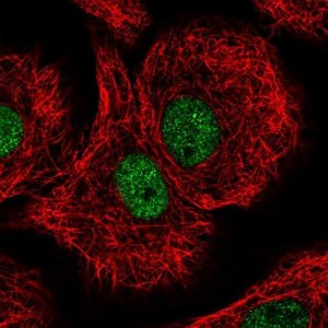 Anti-DDB1 antibody produced in rabbit 