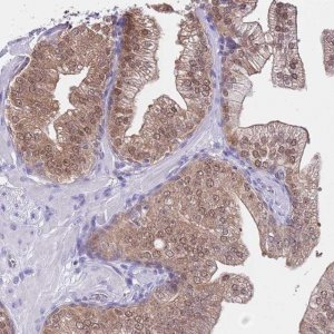 Anti-DDI2 antibody produced in rabbit 