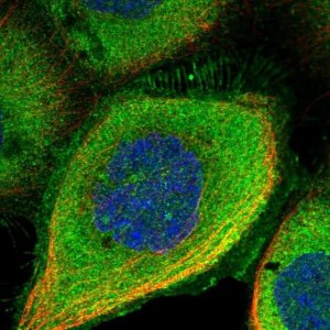 Anti-DDIAS antibody produced in rabbit 