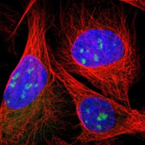 Anti-DDX10 antibody produced in rabbit 