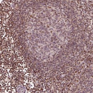 Anti-DDX11 antibody produced in rabbit 