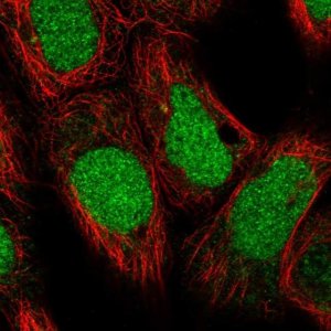 Anti-DDX11 antibody produced in rabbit 
