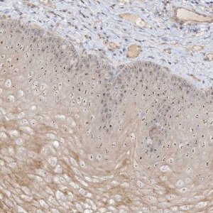 Anti-DDX18 antibody produced in rabbit 