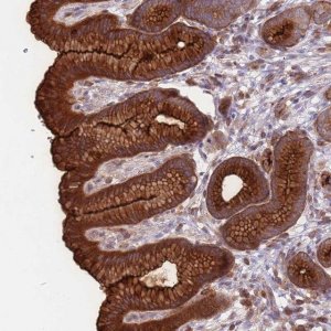 Anti-DDX19B antibody produced in rabbit HPA046380-100UL
