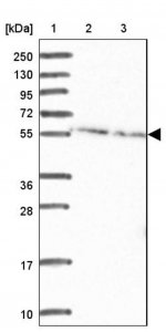 Anti-DDX19B antibody produced in rabbit HPA046380-100UL