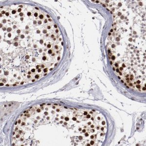 Anti-DDX24 antibody produced in rabbit 