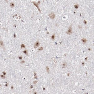 Anti-DDX24 antibody produced in rabbit 