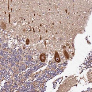 Anti-DDX27 antibody produced in rabbit 