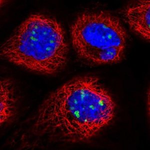 Anti-DDX27 antibody produced in rabbit 