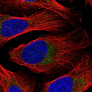 Anti-DDX28 antibody produced in rabbit 