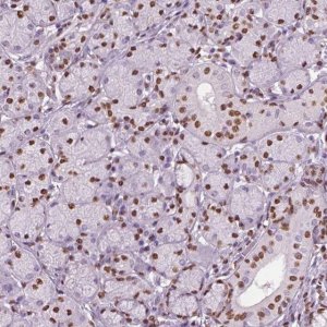 Anti-DDX3X antibody produced in rabbit 