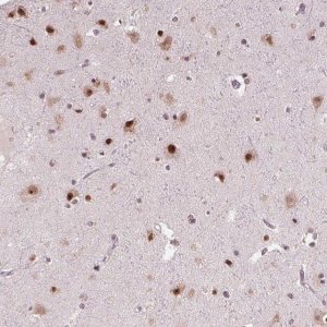 Anti-DDX41 antibody produced in rabbit 
