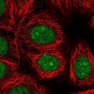 Anti-DDX41 antibody produced in rabbit 
