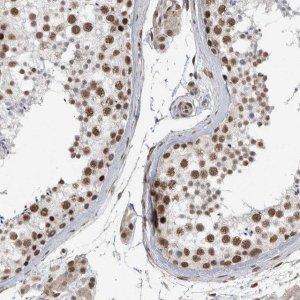 Anti-DDX42 antibody produced in rabbit 