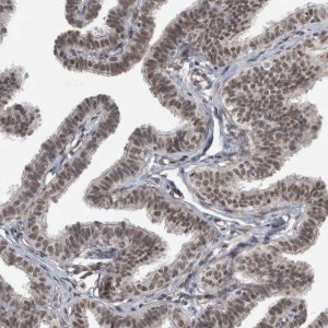 Anti-DDX42 antibody produced in rabbit 