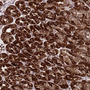 Anti-DDX49 antibody produced in rabbit 
