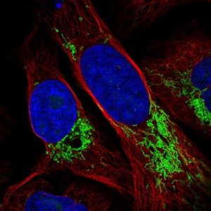 Anti-DDX49 antibody produced in rabbit 