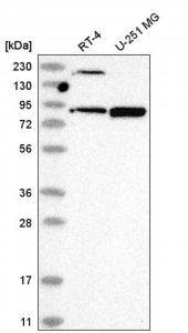 Anti-DDX50 antibody produced in rabbit 