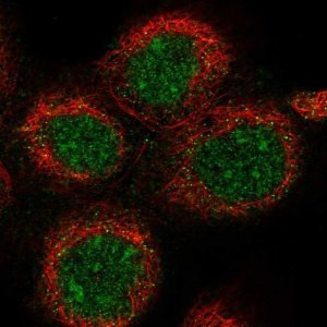 Anti-DDX51 antibody produced in rabbit 