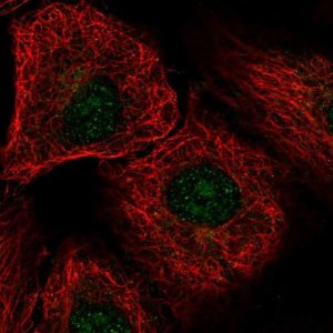 Anti-DDX54 antibody produced in rabbit 