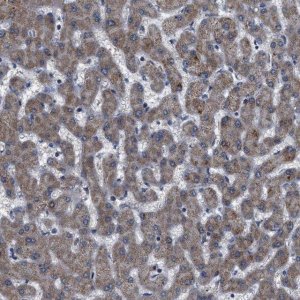 Anti-DDX56 antibody produced in rabbit HPA019749-100UL