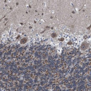 Anti-DDX56 antibody produced in rabbit HPA019749-100UL
