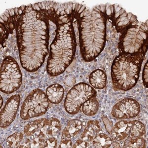 Anti-DDX60 antibody produced in rabbit 
