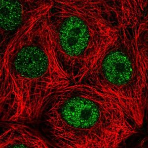 Anti-DEDD antibody produced in rabbit HPA030681-100UL