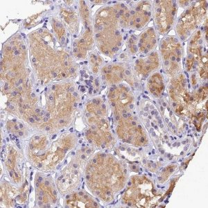 Anti-DGKH antibody produced in rabbit 