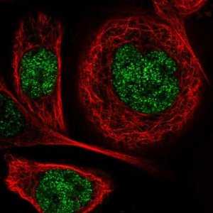 Anti-DGKI antibody produced in rabbit 