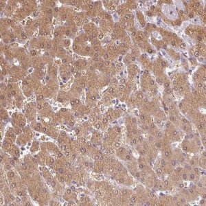 Anti-DGUOK antibody produced in rabbit 