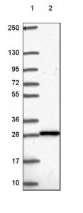 Anti-DGUOK antibody produced in rabbit 