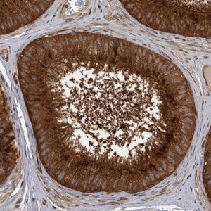 Anti-DHDDS antibody produced in rabbit 