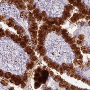 Anti-DHDH antibody produced in rabbit 