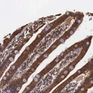 Anti-DHRS1 antibody produced in rabbit 