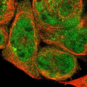 Anti-DHRS1 antibody produced in rabbit 