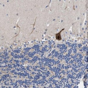Anti-DHRS13 antibody produced in rabbit 