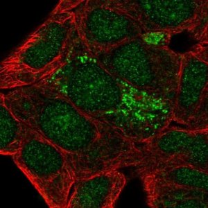 Anti-DHRS2 antibody produced in rabbit 