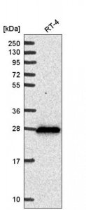 Anti-DHRS2 antibody produced in rabbit 